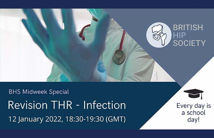 Midweek Special - Revision THR - Infection