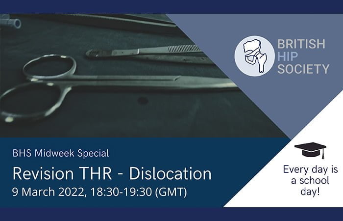 Midweek Special - Revision THR - Dislocation